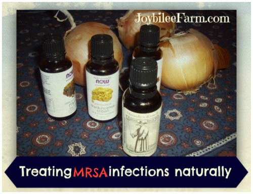 What reputable medical websites have pictures of MRSA infections?