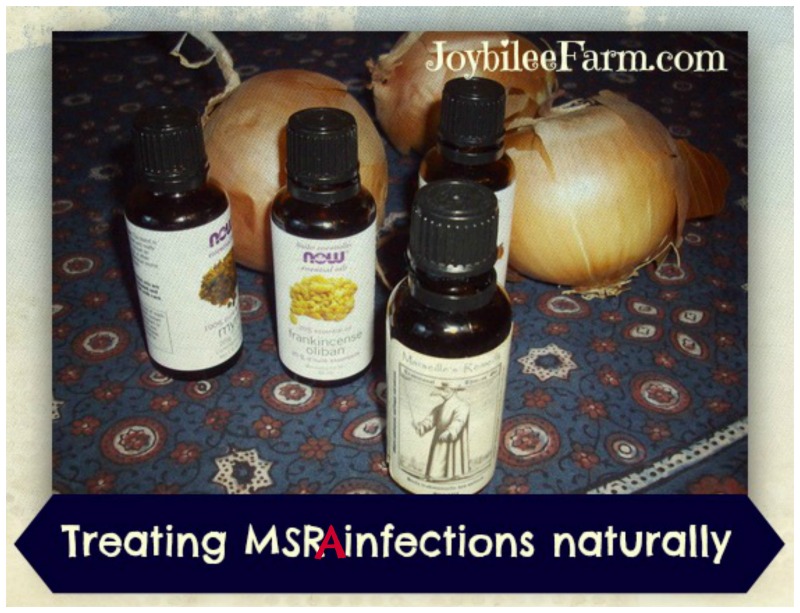 Treating an MRSA infection naturally Joybilee Farm