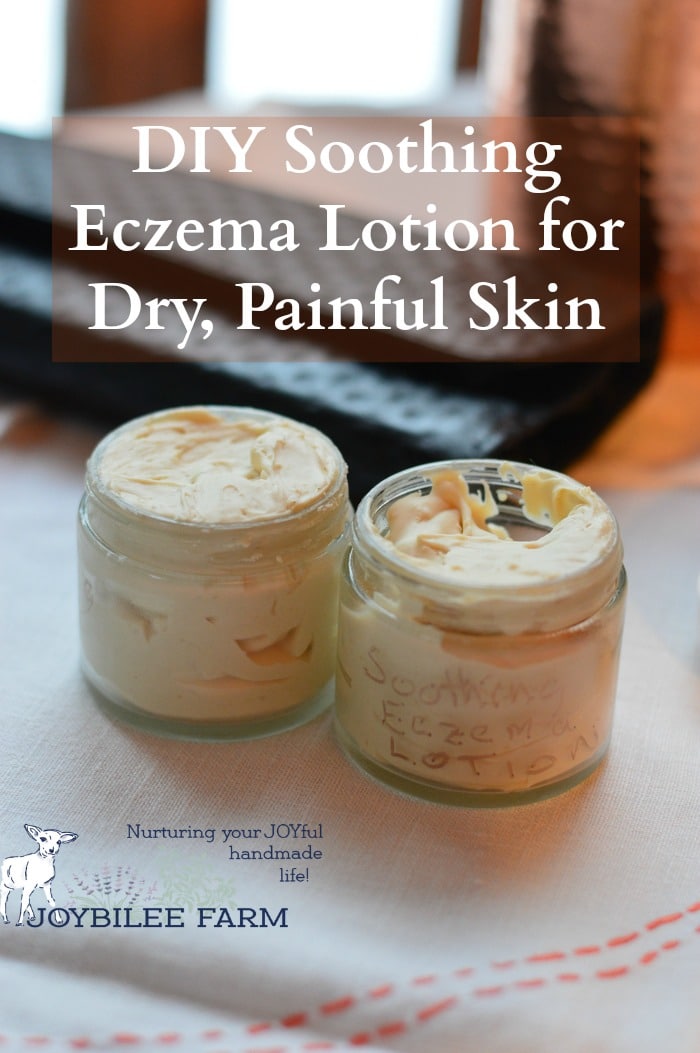 Diy Soothing Eczema Cream For Dry Painful Skin Joybilee Farm Diy Herbs Gardening